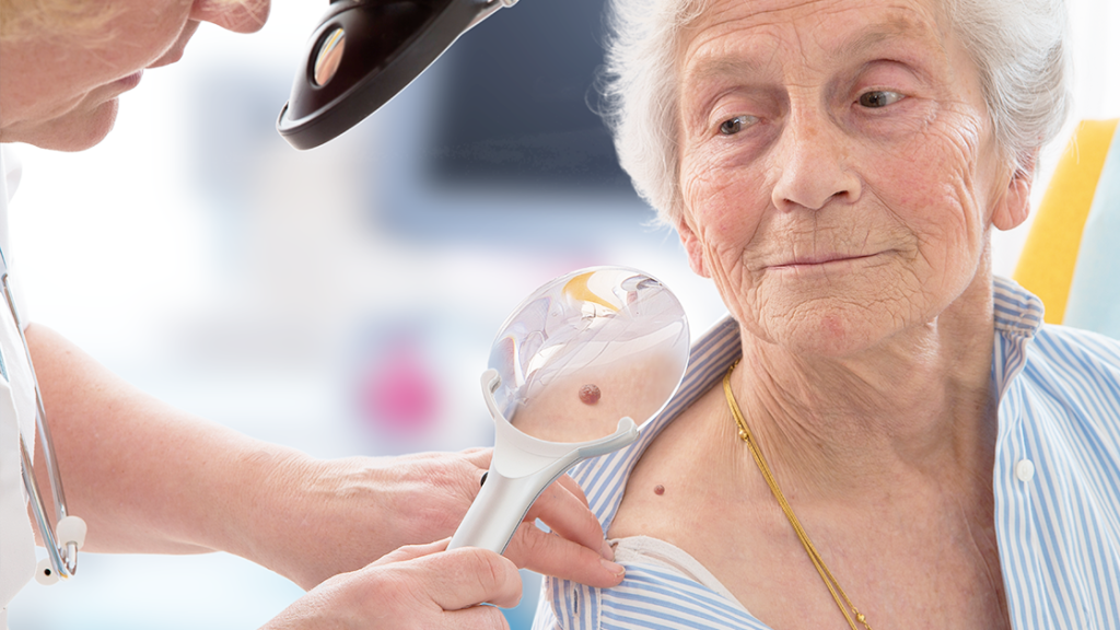 Elderly woman having skin tag examined by female dermatologist.